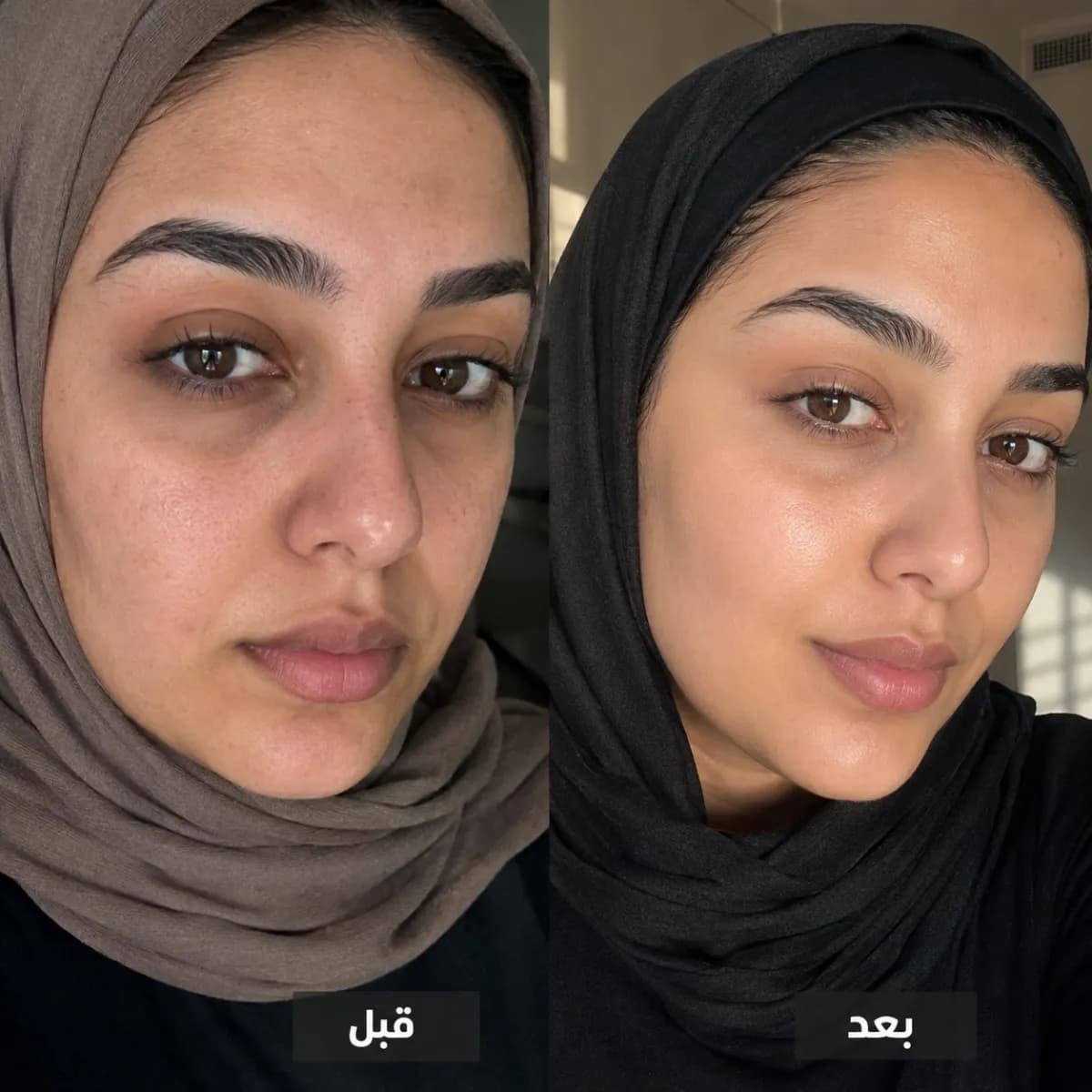تركيبة تدلّل بشرتكِ