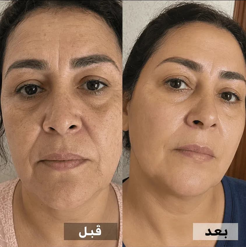 تأثير ملحوظ بمكوّنات قويّة