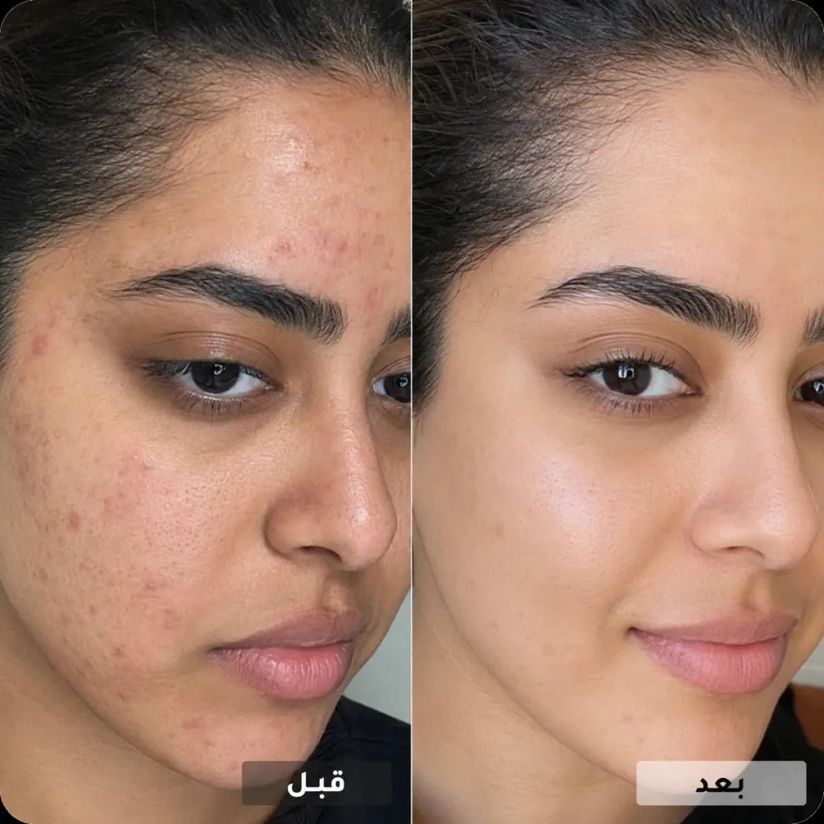بشرة صحّية ونضرة وناعمة