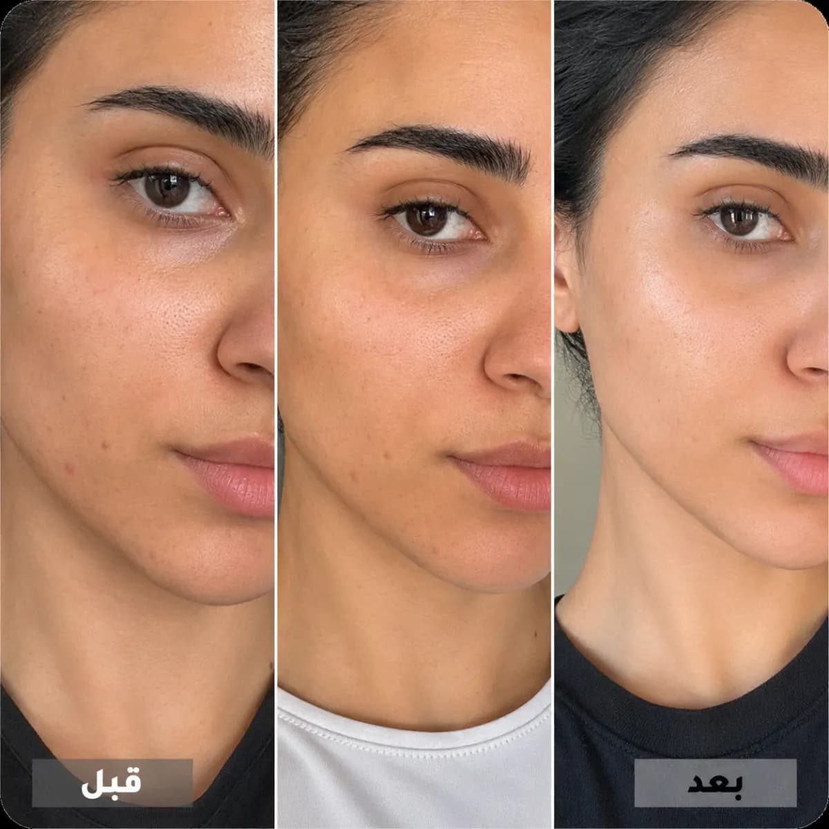 وداعاً للمظهر الباهت والجاف
