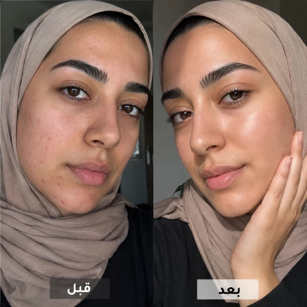 فرقٌ تلمسينه بوضوح