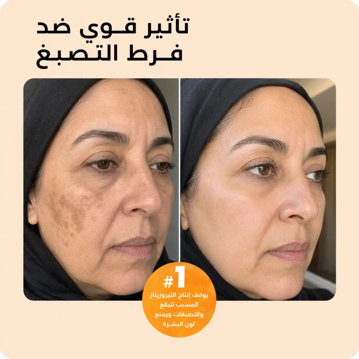 بار التنظيف — Kojiso™