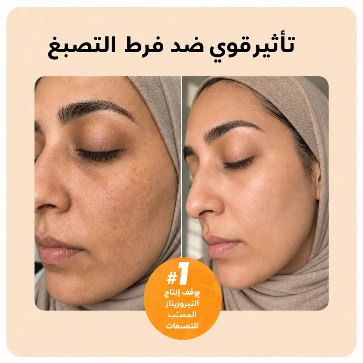 بار التنظيف — Kojiso™
