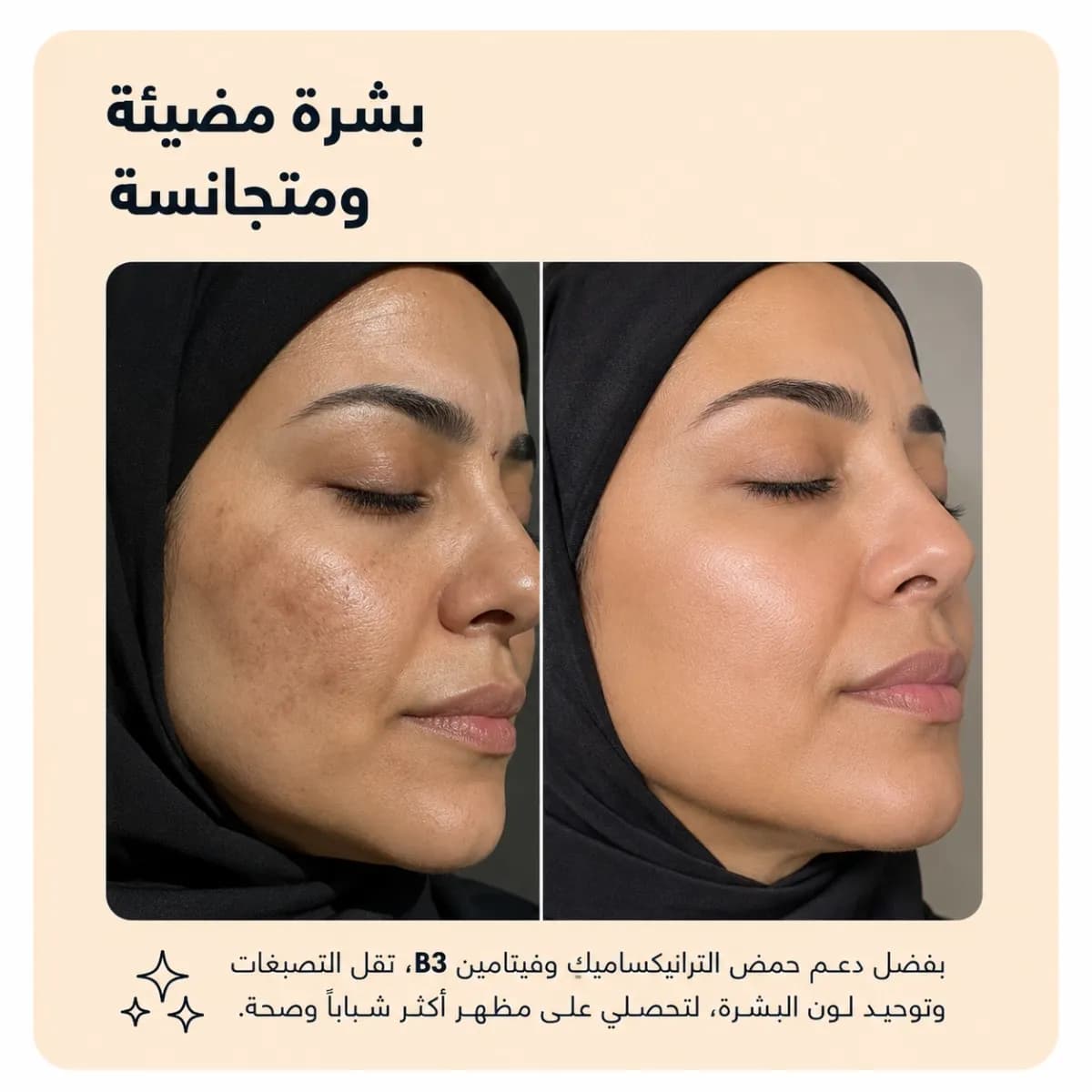 سيروم مكافحة البقع — Kojiso™