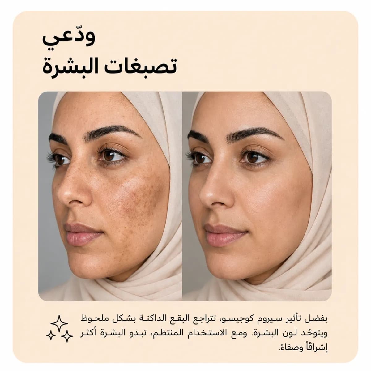سيروم مكافحة البقع — Kojiso™