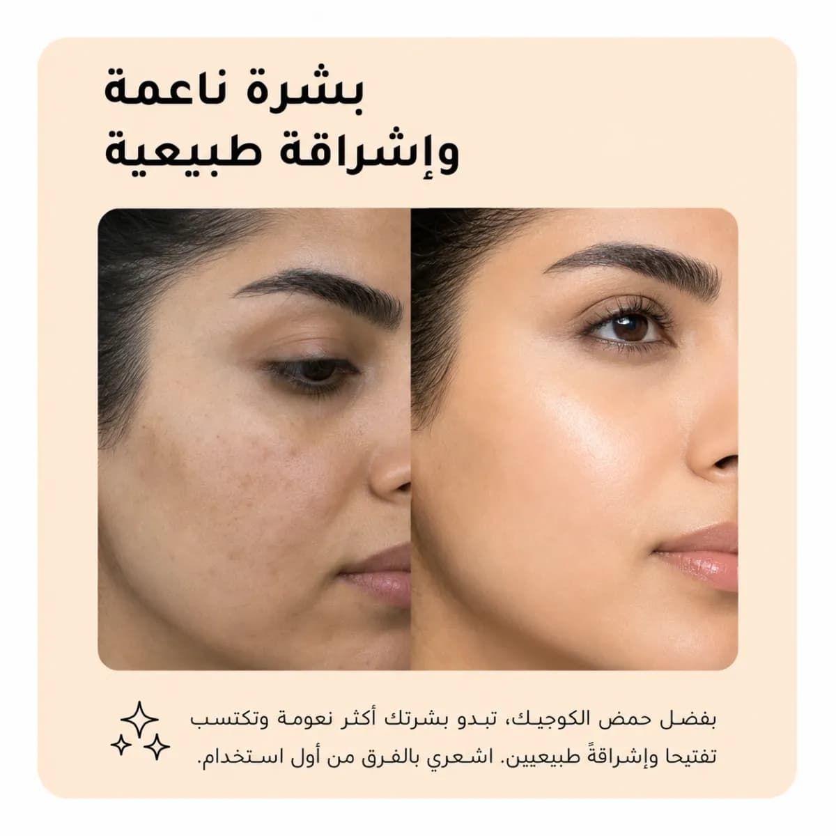 سيروم مكافحة البقع — Kojiso™