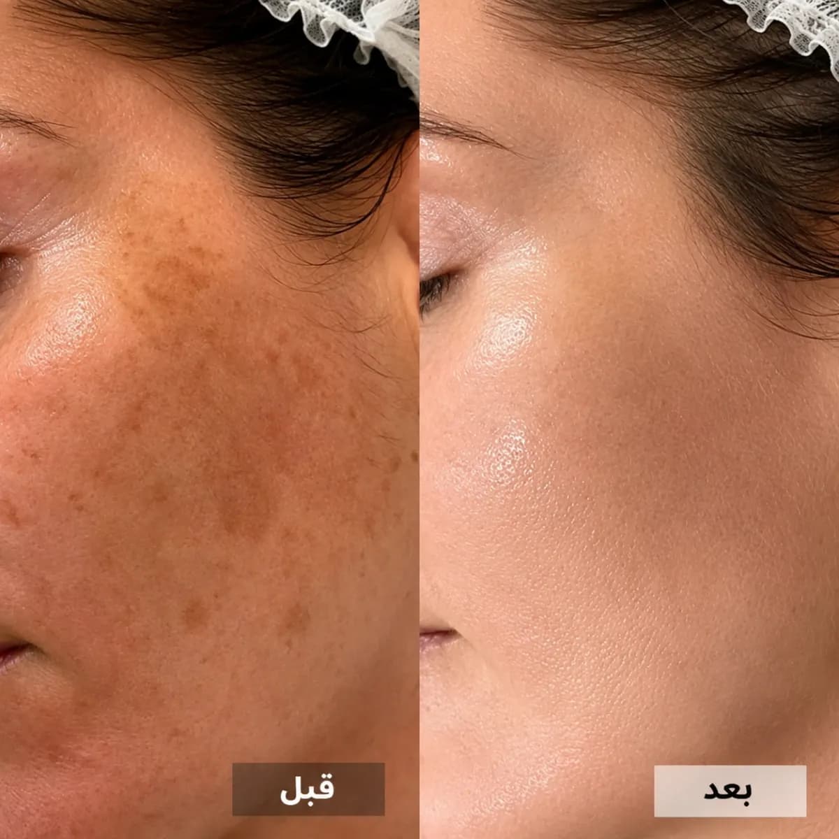 أشرقي طبيعياً لا بالمكياج