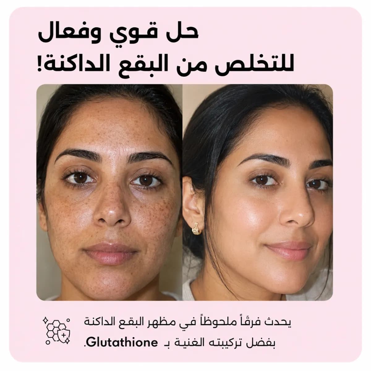 سيروم التفتيح — Light Up™