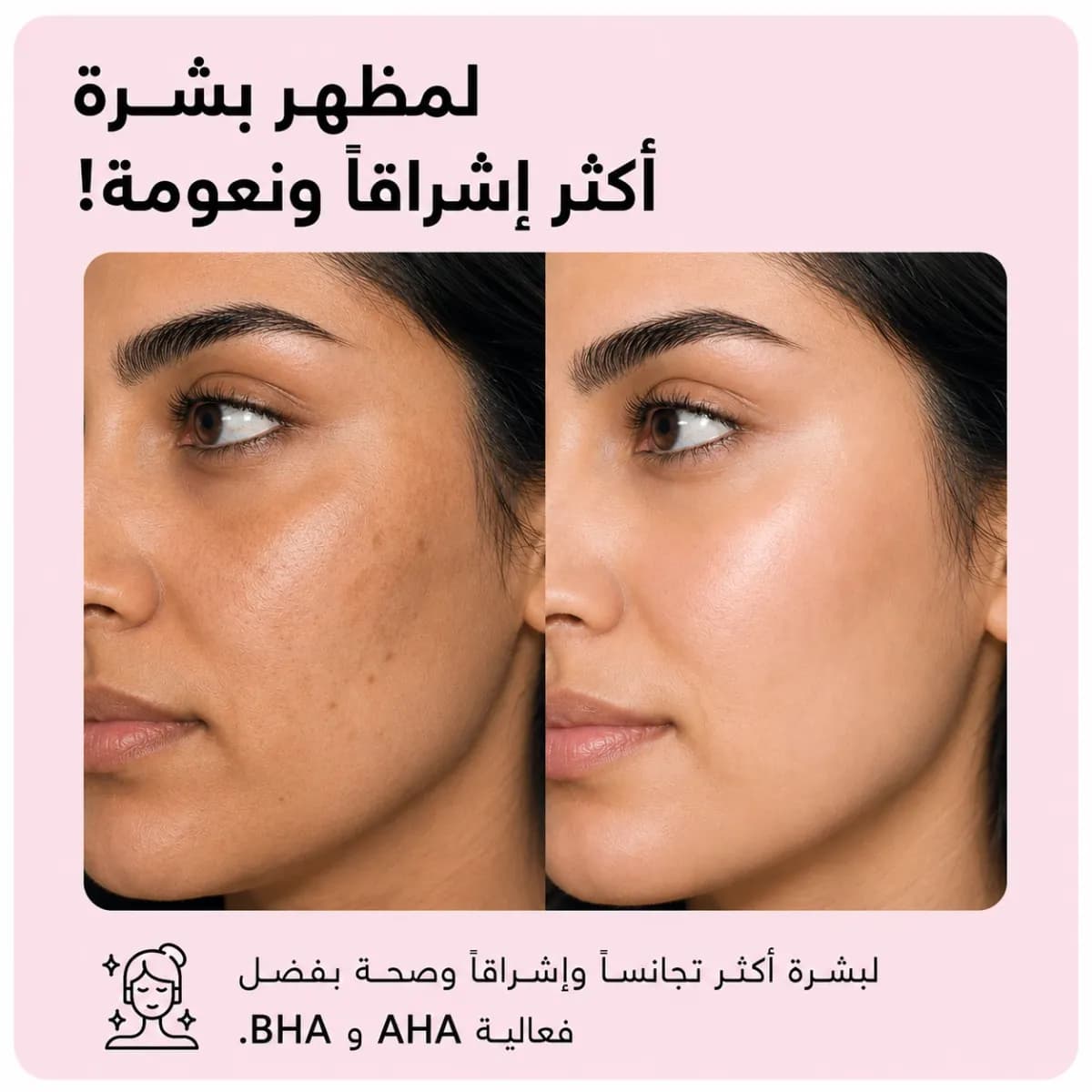 سيروم التفتيح — Light Up™