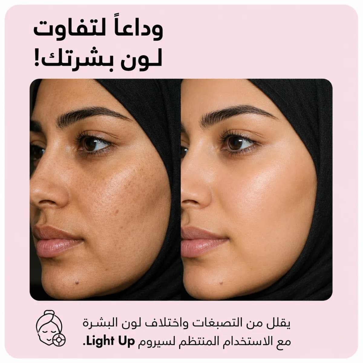 سيروم التفتيح — Light Up™