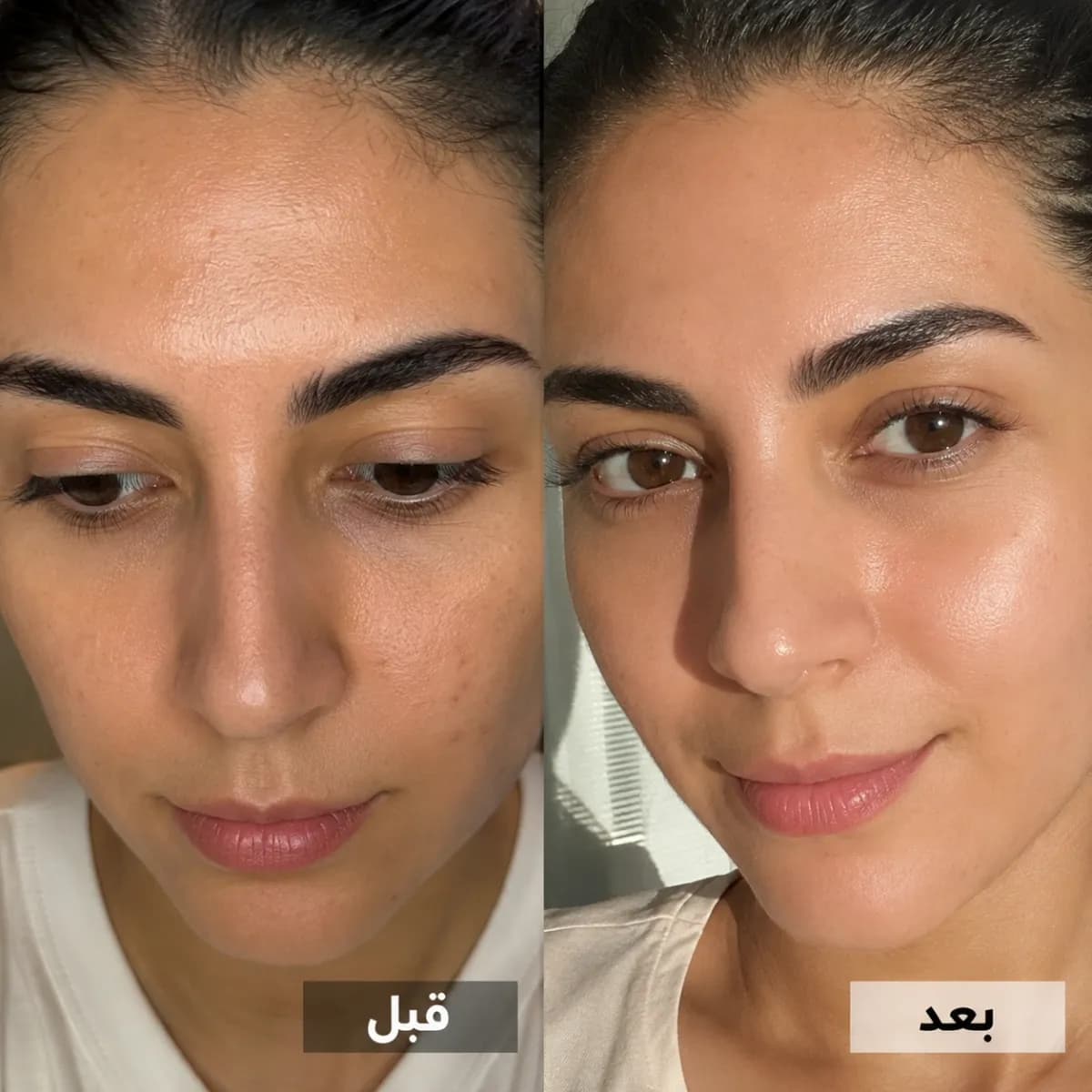 امنحي لون بشرتكِ إشراقاً