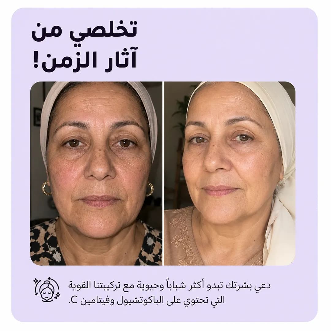 بار التنظيف — Retinage™