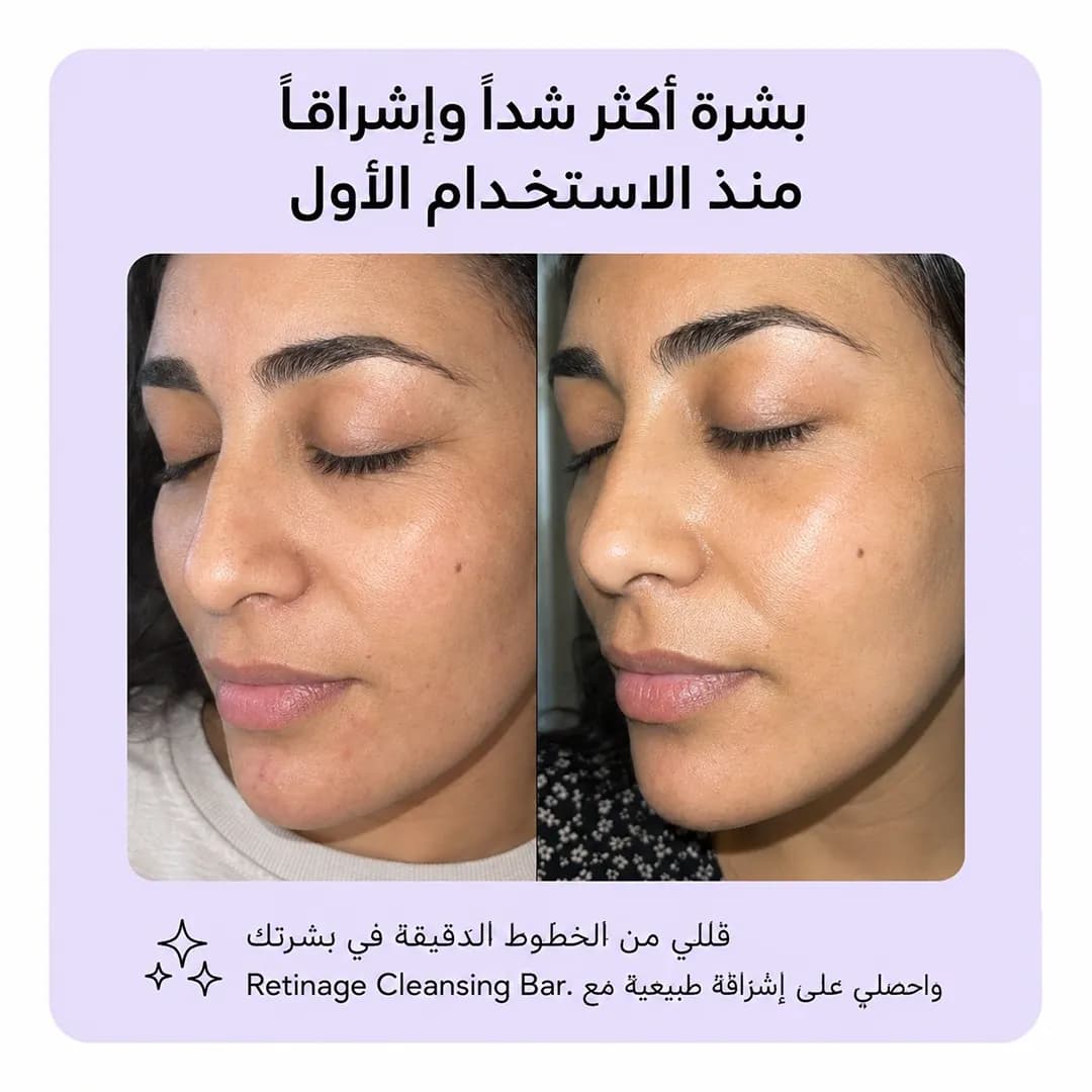 بار التنظيف — Retinage™