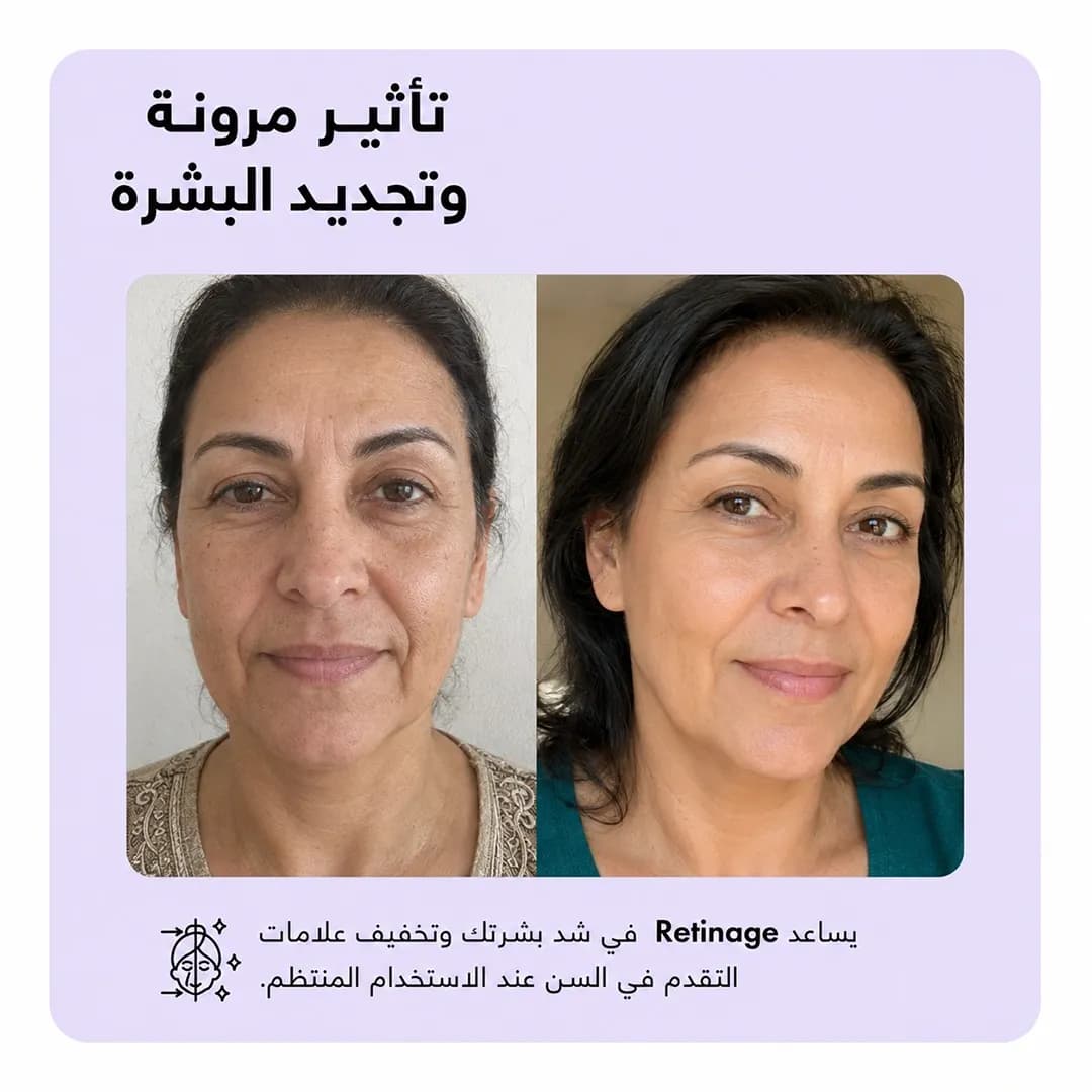 بار التنظيف — Retinage™