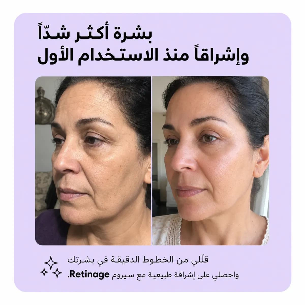 سيروم تجديد البشرة — Retinage™