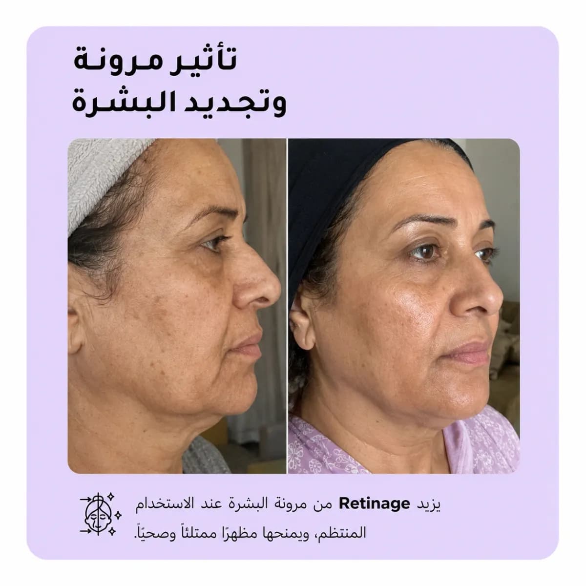 سيروم تجديد البشرة — Retinage™