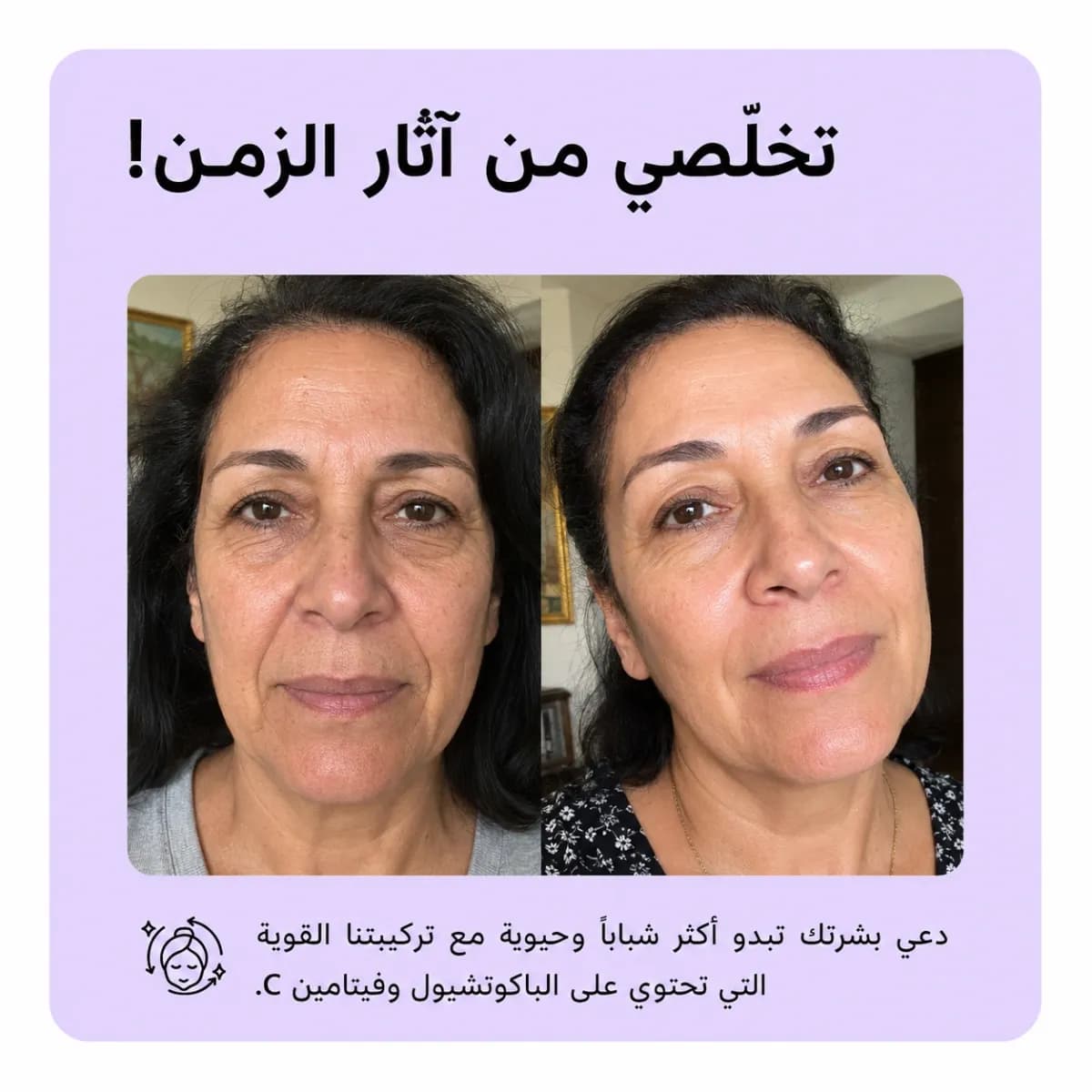 سيروم تجديد البشرة — Retinage™