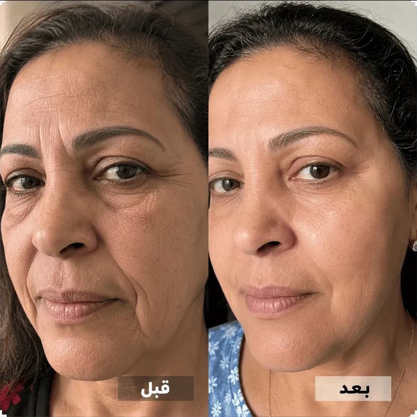 أشرقي بالعناية لا بمرور الوقت