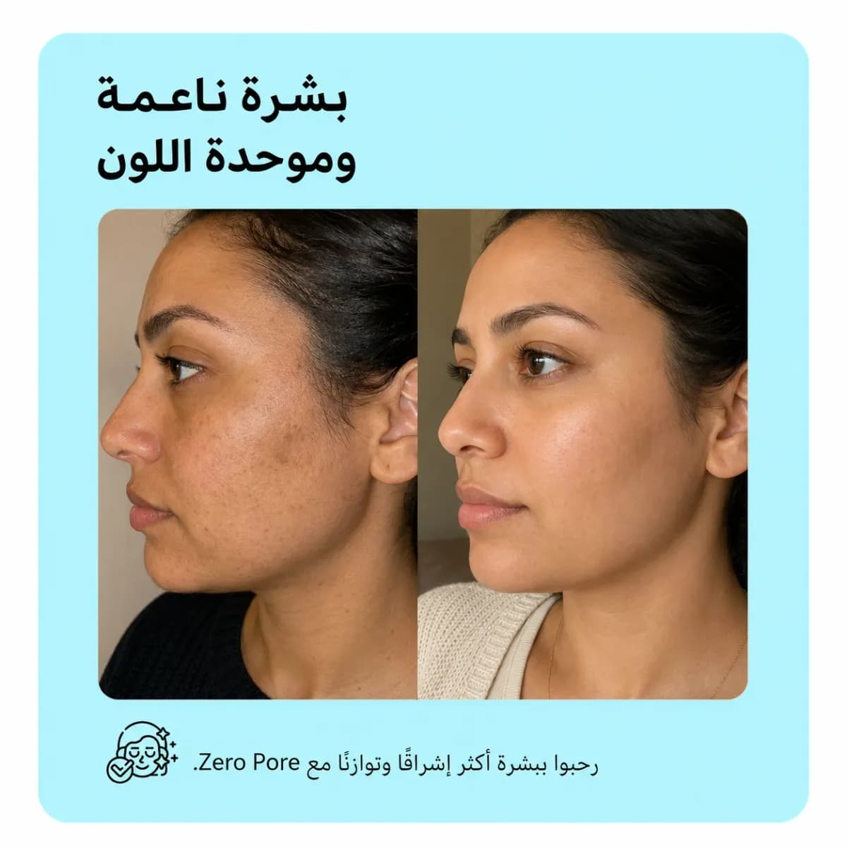 سيروم تصغير المسام — Zero Pore™